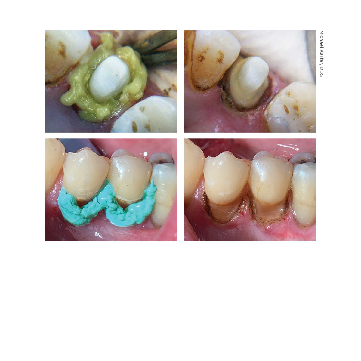 Dryz dental clinical images