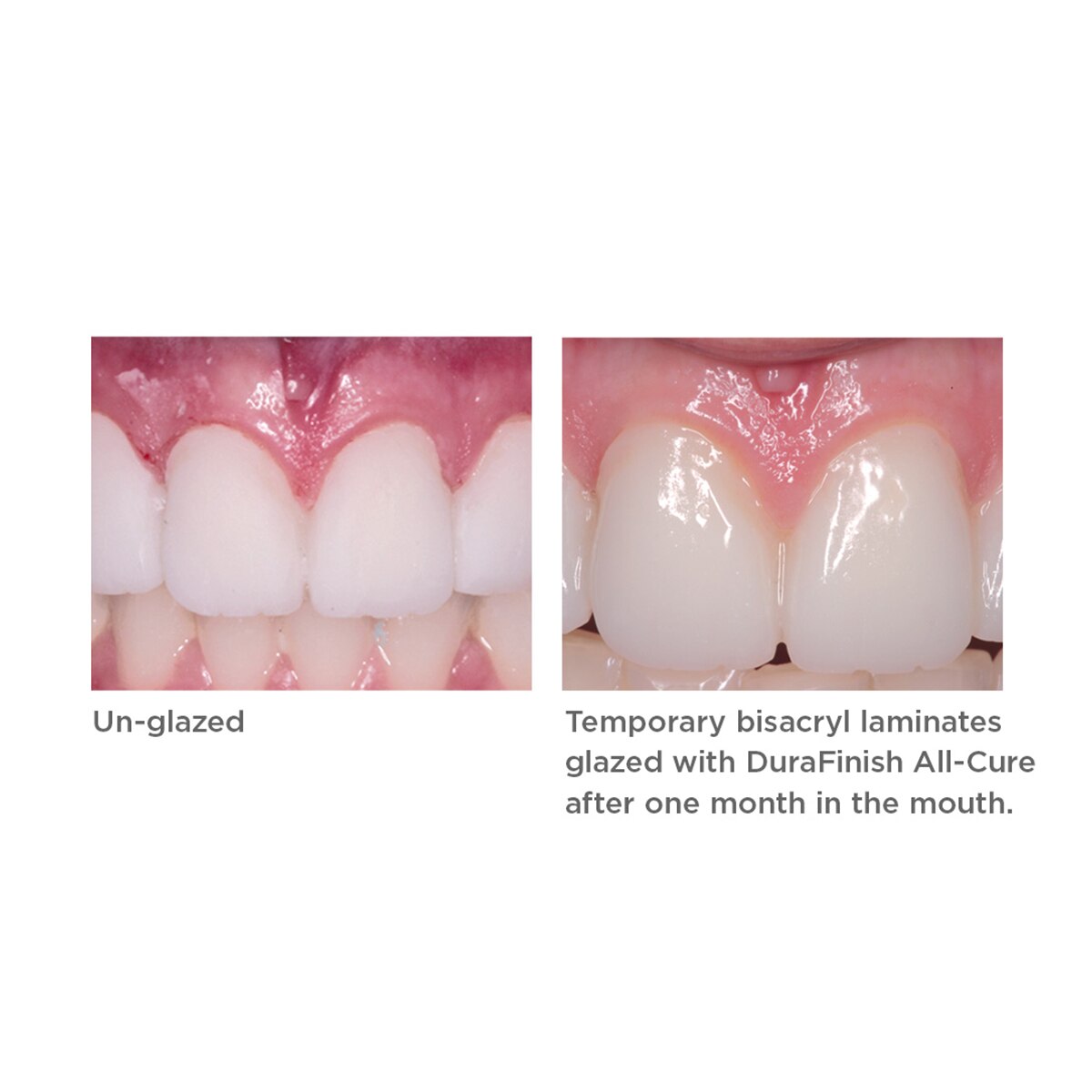 DuraFinish clinical images