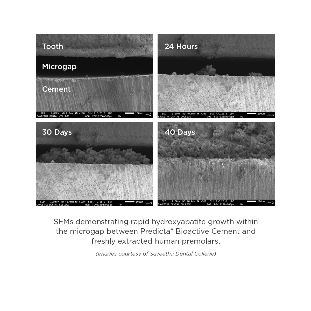 Predicta Cement clinical SEM images